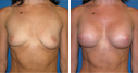 Before & After Photos